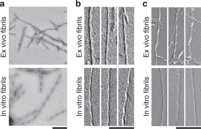 Cryo Em Structure And Polymorphism Of Ab Amyloid Fibrils Purified From Alzheimer S Brain Tissue Nature Communications