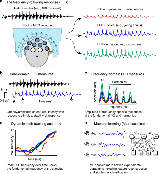 Evolving perspectives on the sources of the frequency-following response | Nature Communications boys-boxer-swim-shorts-rayures-bal-harbour-shops
