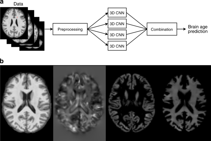 The Professional Brain Age Test