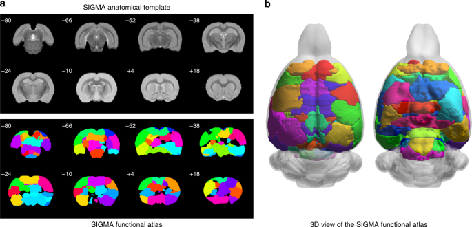 The SIGMA rat brain templates and atlases for multimodal MRI data analysis  and visualization | Nature Communications