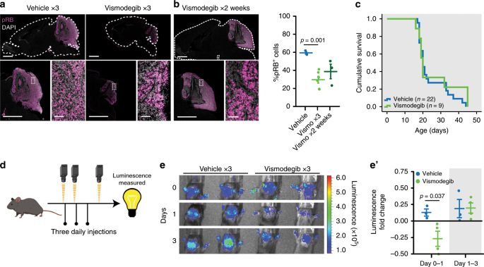 scRNA-seq in medulloblastoma shows cellular heterogeneity and lineage  expansion support resistance to SHH inhibitor therapy | Nature  Communications