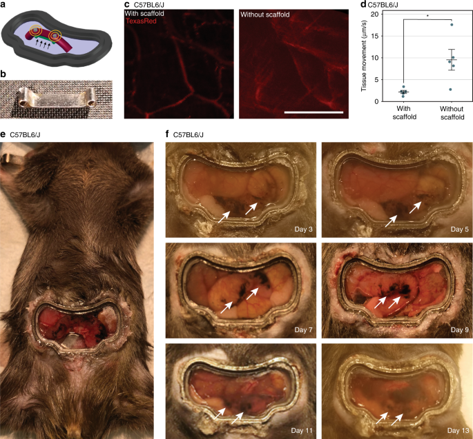 An Intravital Window To Image The Colon In Real Time Nature Communications