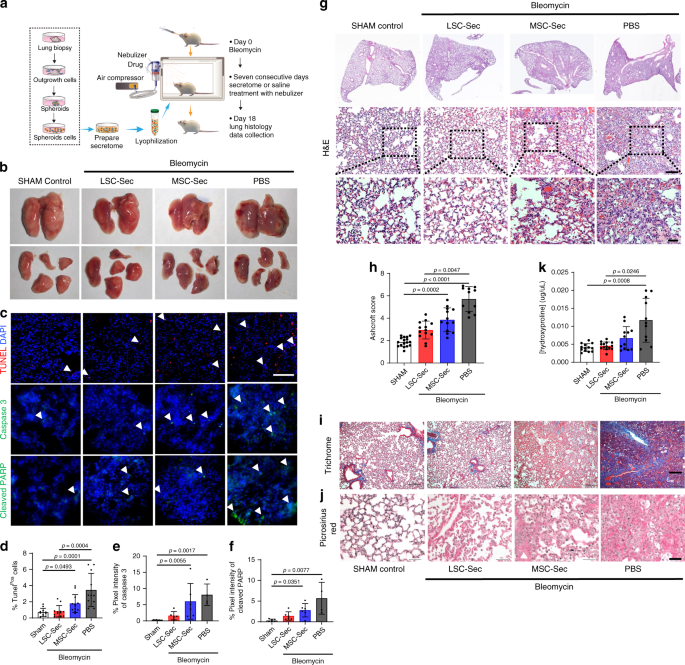 Inhalation Of Lung Spheroid Cell Secretome And Exosomes Promotes Lung Repair In Pulmonary Fibrosis Nature Communications