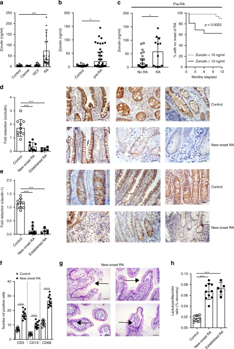 Targeting zonulin and intestinal epithelial barrier function to prevent onset of arthritis