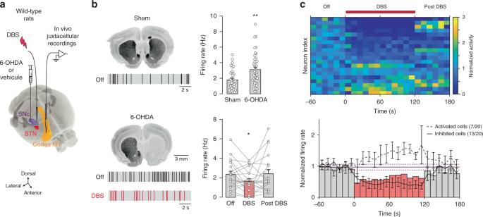 Deep Brain Stimulation Guided Optogenetic Rescue Of Parkinsonian Symptoms Nature Communications