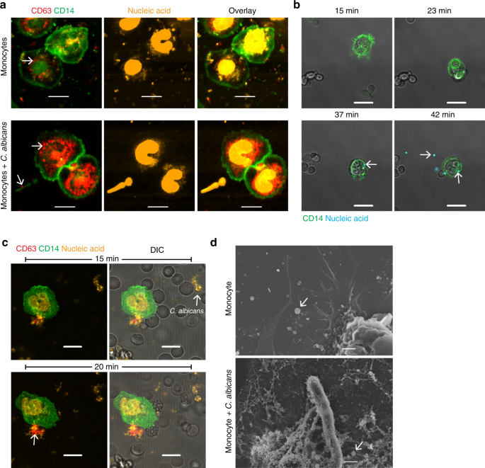 Immune Modulation By Complement Receptor 3 Dependent Human Monocyte Tgf B1 Transporting Vesicles Nature Communications