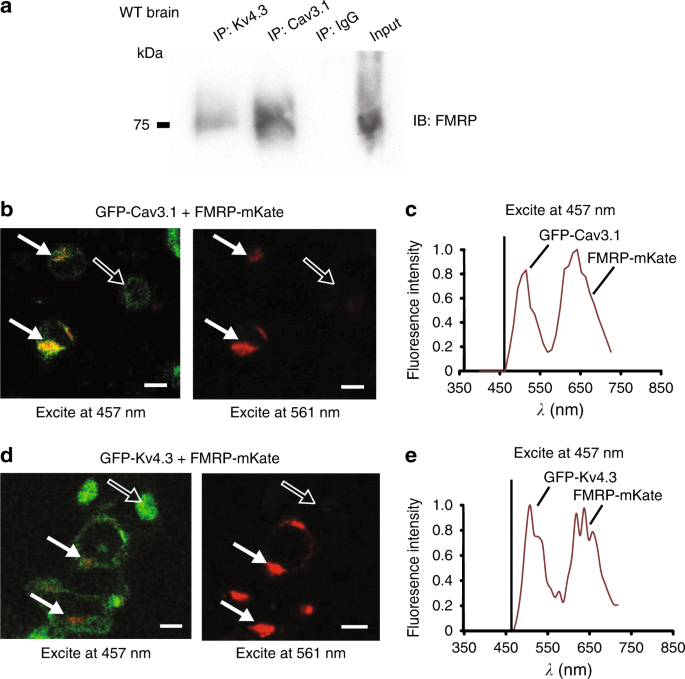 FMRP(1–297)-tat restores ion channel and synaptic function in a
