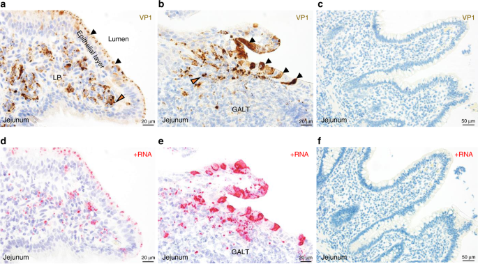Human norovirus targets enteroendocrine epithelial cells in the small intestine