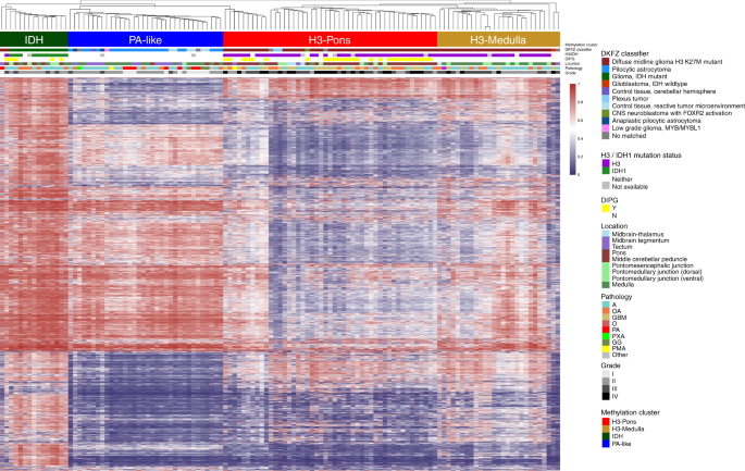 The integrated genomic and epigenomic landscape of brainstem glioma