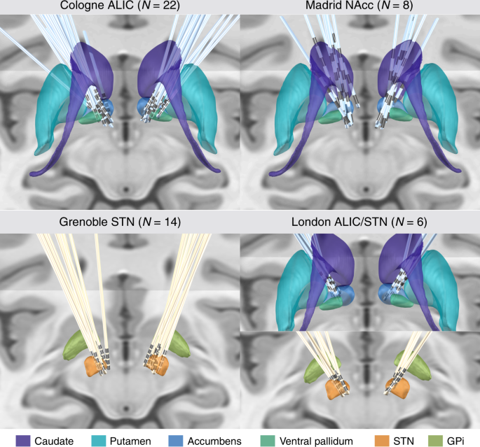 feature-image