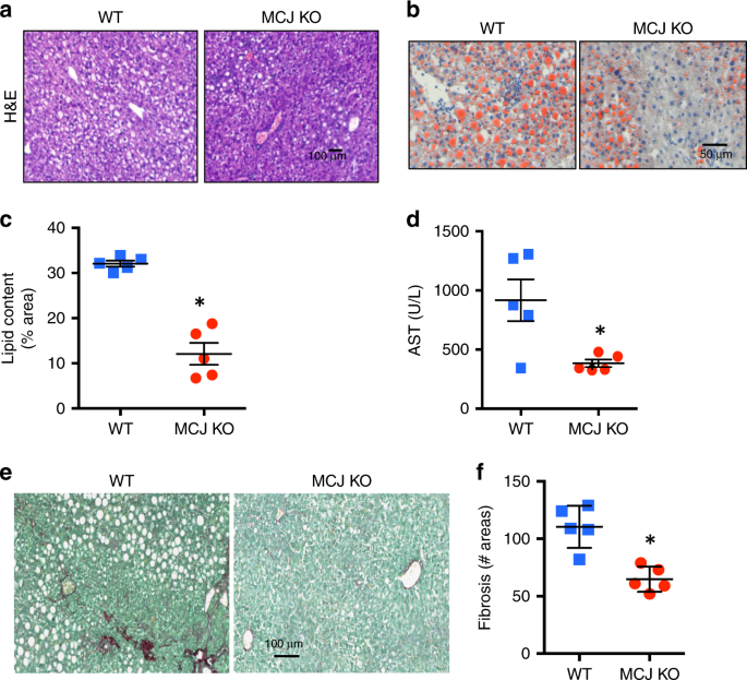 Silencing Hepatic Mcj Attenuates Non Alcoholic Fatty Liver Disease Nafld By Increasing Mitochondrial Fatty Acid Oxidation Nature Communications