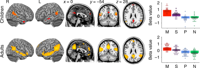 Evidence of an association between sign language phonological awareness and  word reading in deaf and hard-of-hearing children - ScienceDirect