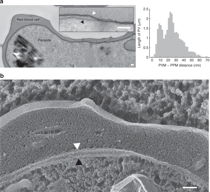 Contacting Domains Segregate A Lipid Transporter From A Solute Transporter In The Malarial Host Parasite Interface Nature Communications Contacting Domains Segregate A Lipid Transporter From A Solute Transporter In The Malarial Host Parasite Interface Nature Communications