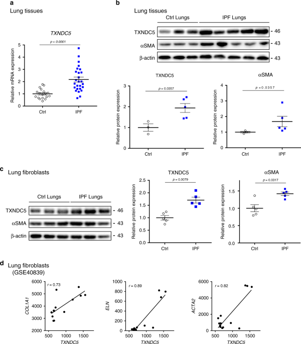 Fibroblast Enriched Endoplasmic Reticulum Protein Txndc5 Promotes Pulmonary Fibrosis By Augmenting Tgfb Signaling Through Tgfbr1 Stabilization Nature Communications Fibroblast Enriched Endoplasmic Reticulum Protein Txndc5 Promotes Pulmonary Fibrosis By Augmenting Tgfb Signaling Through Tgfbr1 Stabilization Nature Communications
