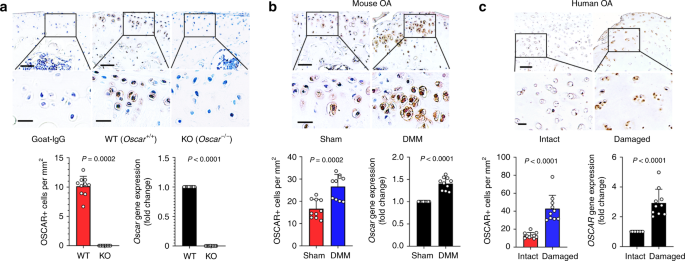 Osteoclast Associated Receptor Blockade Prevents Articular Cartilage Destruction Via Chondrocyte Apoptosis Regulation Nature Communications