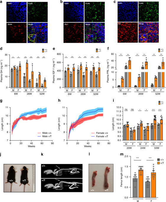 Gpr101 Drives Growth Hormone Hypersecretion And Gigantism In Mice Via Constitutive Activation Of G S And G Q 11 Nature Communications