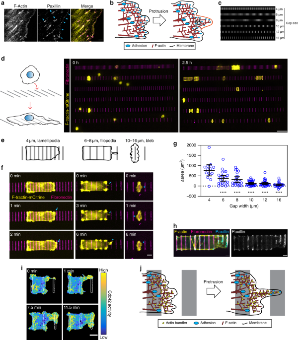 T Plastin Reinforces Membrane Protrusions To Bridge Matrix Gaps During Cell Migration Nature Communications