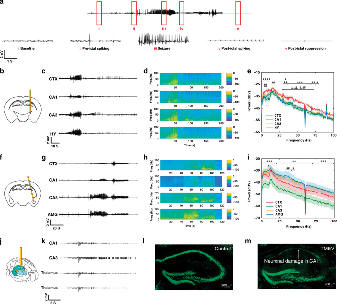 A Versatile Synthetic Affinity Probe Reveals Inhibitory Synapse  Ultrastructure and Brain Connectivity** - Khayenko - 2022 - Angewandte  Chemie International Edition - Wiley Online Library