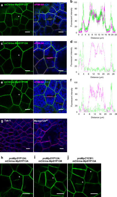 The Liverwort Oil Body Is Formed By Redirection Of The Secretory Pathway Nature Communications