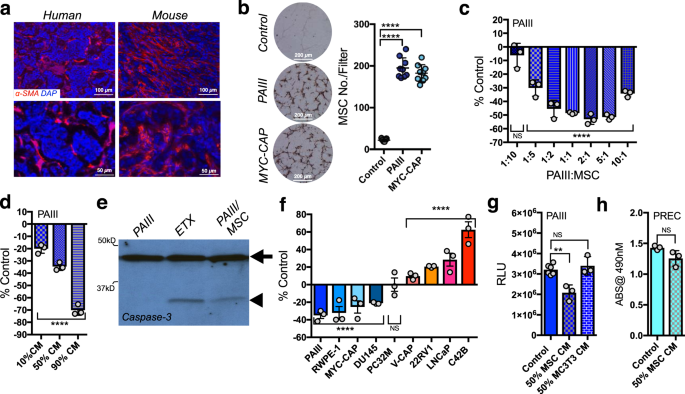 Mesenchymal Stem Cell Derived Interleukin 28 Drives The Selection Of Apoptosis Resistant Bone Metastatic Prostate Cancer Nature Communications