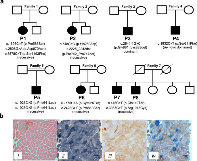 Polrmt Mutations Impair Mitochondrial Transcription Causing Neurological Disease Nature Communications