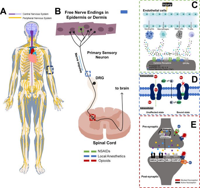 Nerve Stimulation Helps Manage Pain Without Opioids