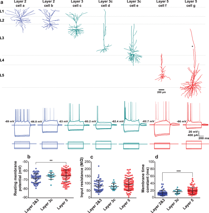 Diversity amongst human cortical pyramidal neurons revealed via their sag  currents and frequency preferences