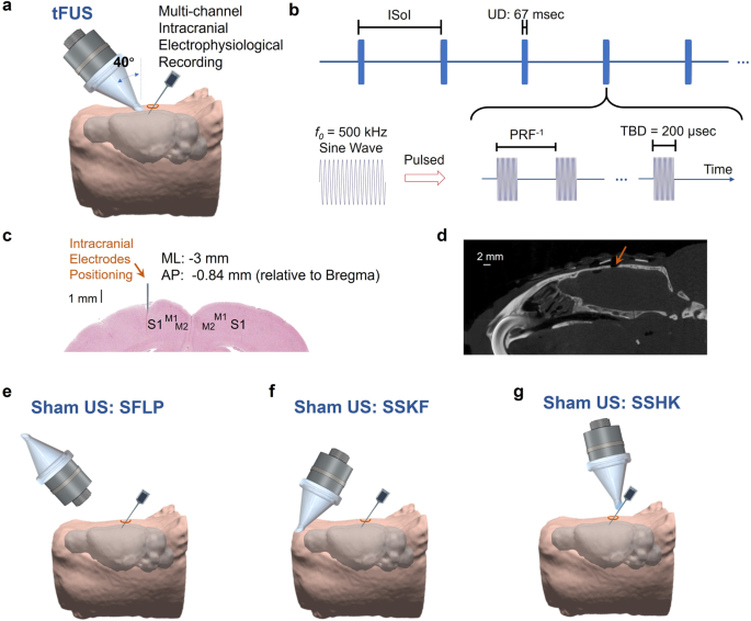 Intrinsic Functional Neuron Type Selectivity Of Transcranial Focused Ultrasound Neuromodulation Nature Communications
