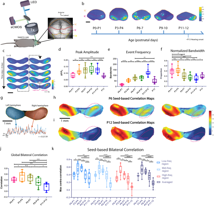 Efferent Feedback Controls Bilateral Auditory Spontaneous Activity Nature Communications