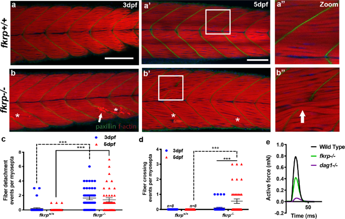 Fkrp Dependent Glycosylation Of Fibronectin Regulates Muscle Pathology In Muscular Dystrophy Nature Communications Fkrp Dependent Glycosylation Of Fibronectin Regulates Muscle Pathology In Muscular Dystrophy Nature Communications