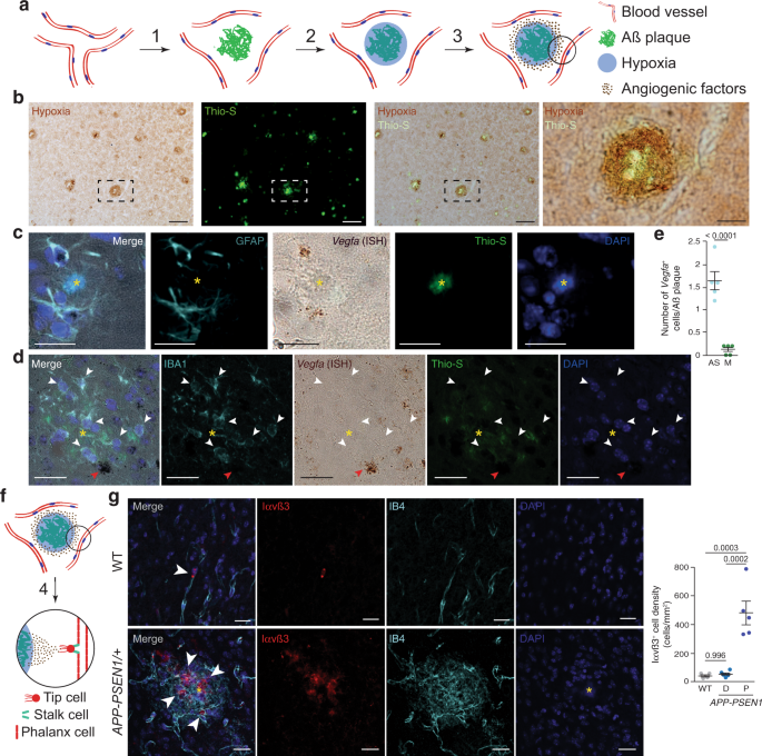 Non Productive Angiogenesis Disassembles Ass Plaque Associated Blood Vessels Nature Communications