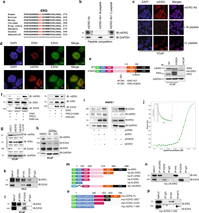 Ezh2 Induced Lysine K362 Methylation Enhances Tmprss2 Erg Oncogenic Activity In Prostate Cancer Nature Communications