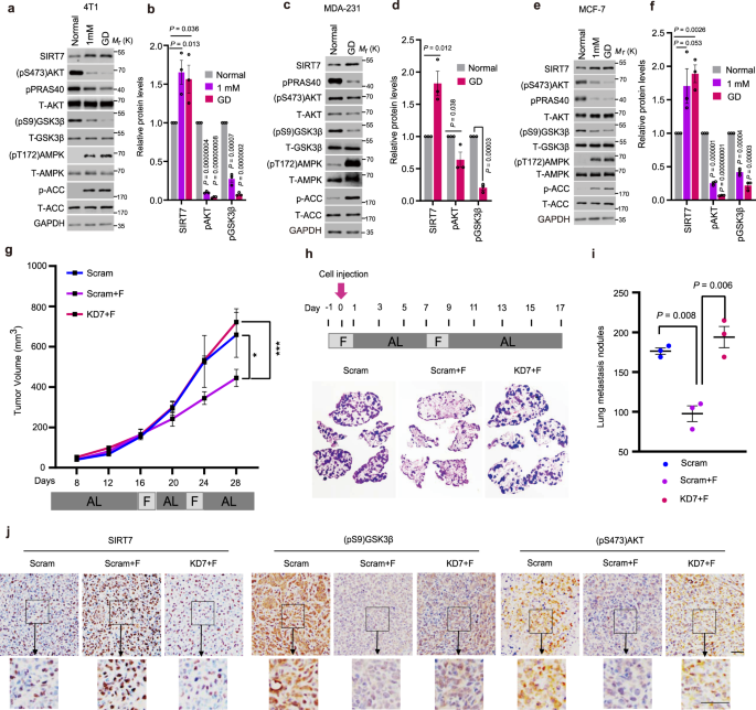 glutathione intermittent fasting Combined intermittent fasting and ERK inhibition enhance the anti-tumor  effects of chemotherapy via the GSK3β-SIRT7 axis