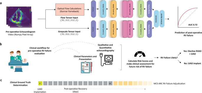 Evaluation and Management of Right-Sided Heart Failure: A