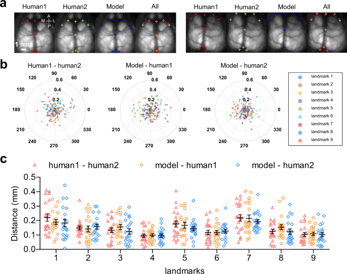 DeepSlice: rapid fully automatic registration of mouse brain imaging to a  volumetric atlas