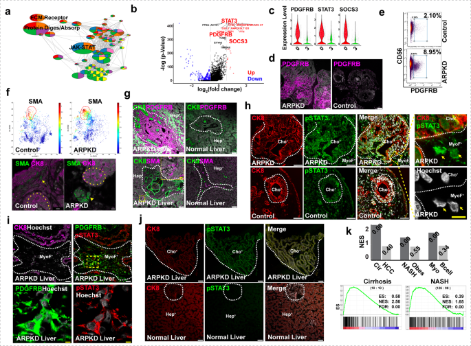 A human multi-lineage hepatic organoid model for liver fibrosis