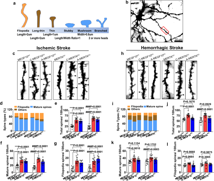 Stroke subtype-dependent synapse elimination by reactive gliosis in mice