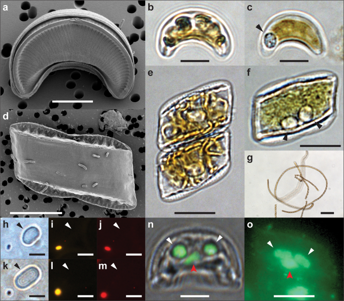 Overlooked And Widespread Pennate Diatom Diazotroph Symbioses In The Sea Nature Communications