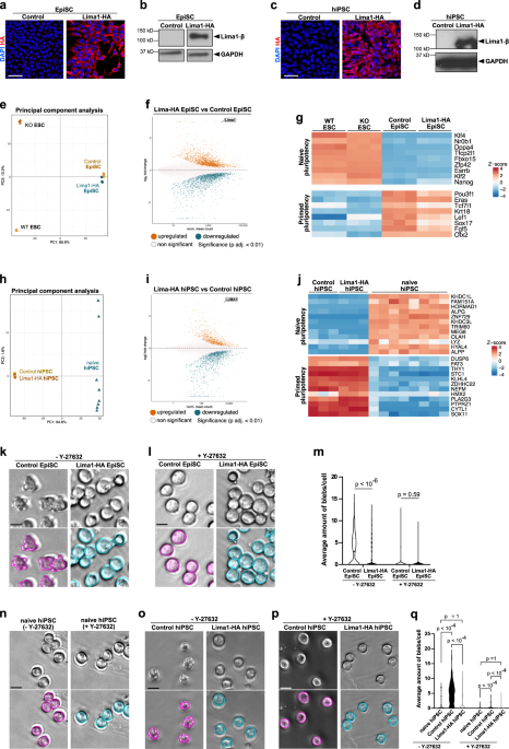 Lima1 mediates the pluripotency control of membrane dynamics and