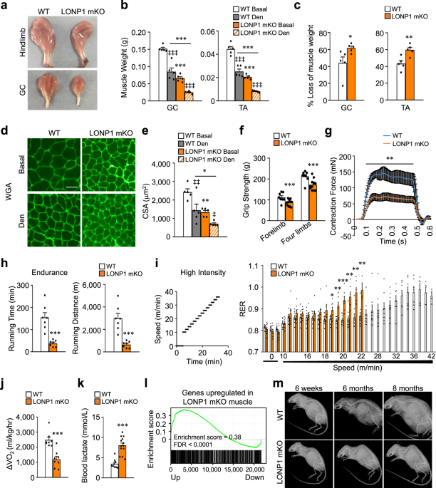 Disuse-associated loss of the protease LONP1 in muscle impairs  mitochondrial function and causes reduced skeletal muscle mass and strength  | Nature Communications