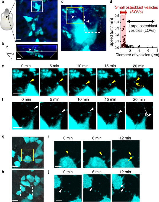 Osteoblast-derived vesicles induce a switch from bone-formation to bone-resorption in vivo