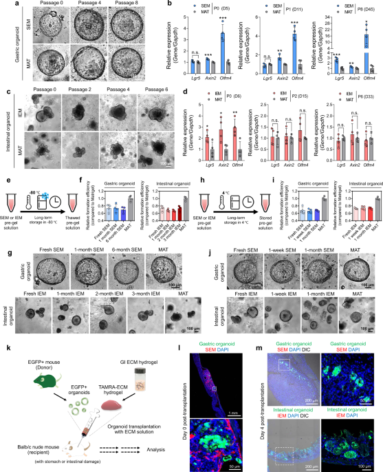 Tissue extracellular matrix hydrogels as alternatives to Matrigel for  culturing gastrointestinal organoids | Nature Communications