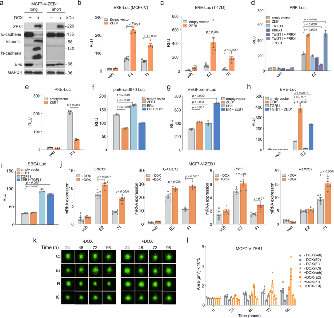 Cooperative interaction between ERα and the EMT-inducer ZEB1 reprograms  breast cancer cells for bone metastasis | Nature Communications