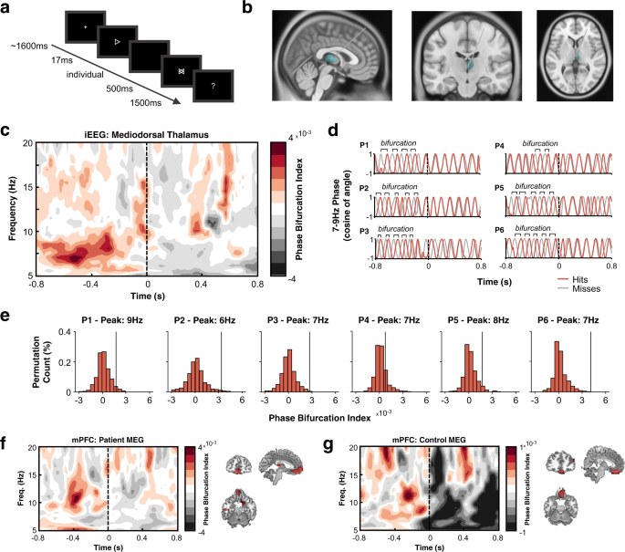 Rhythmic interactions between the mediodorsal thalamus and prefrontal cortex precede human visual perception