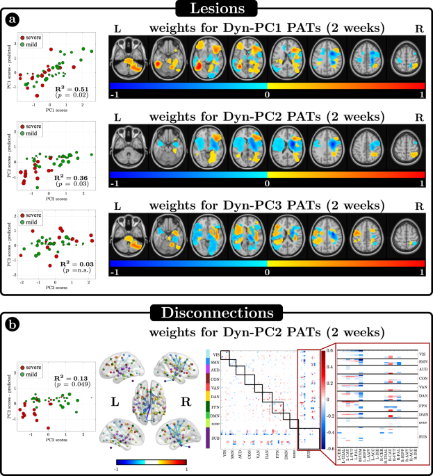 Subcortical-cortical dynamical states of the human brain and their