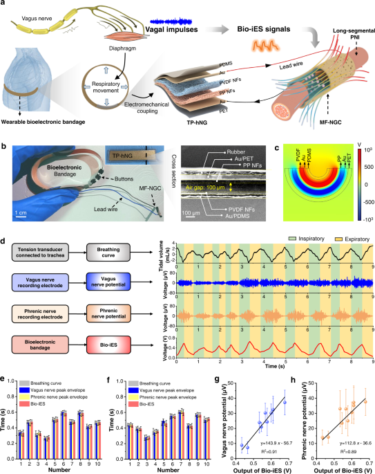 Biofeedback electrostimulation for bionic and long-lasting neural  modulation | Nature Communications