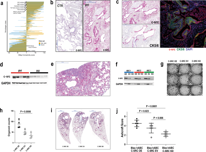 Lung extracellular matrix modulates KRT5+ basal cell activity in pulmonary  fibrosis