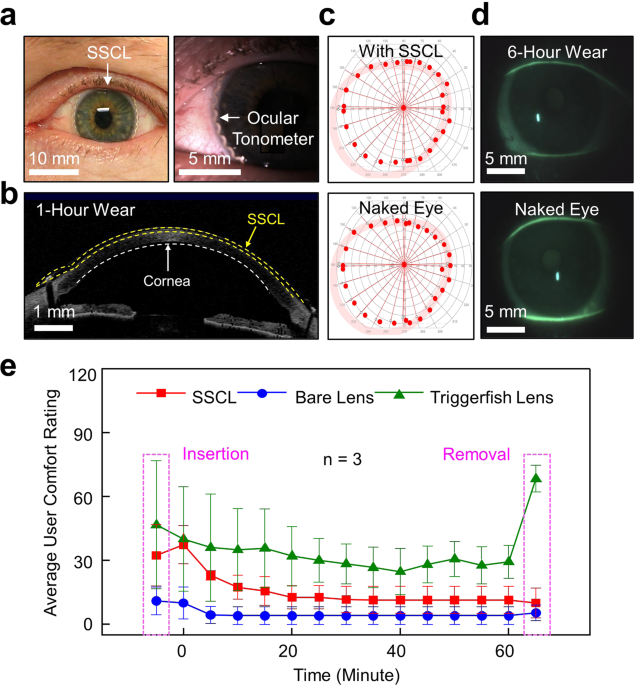Smart soft contact lenses for continuous 24-hour monitoring of