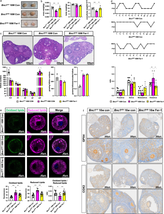 Mitochondrial defects caused by PARL deficiency lead to arrested  spermatogenesis and ferroptosis