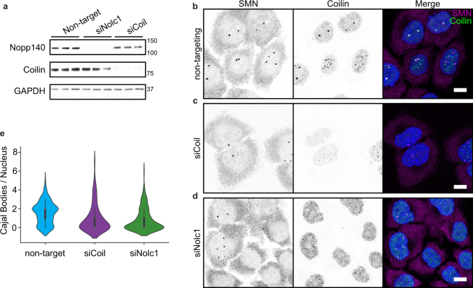 The coilin N-terminus mediates multivalent interactions between coilin and  Nopp140 to form and maintain Cajal bodies | Nature Communications